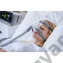 Kép 4/9 - ibreeze-20a-resvent-auto-cpap-apap-legzessegito-berendezes-alvas-segites