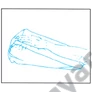 Kép 2/3 - Gyopár S2 kartámasz